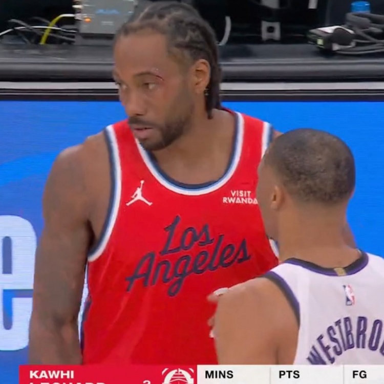 足球直播-小卡眼角被打破血流不止 回更衣室治疗之后已经重回球场